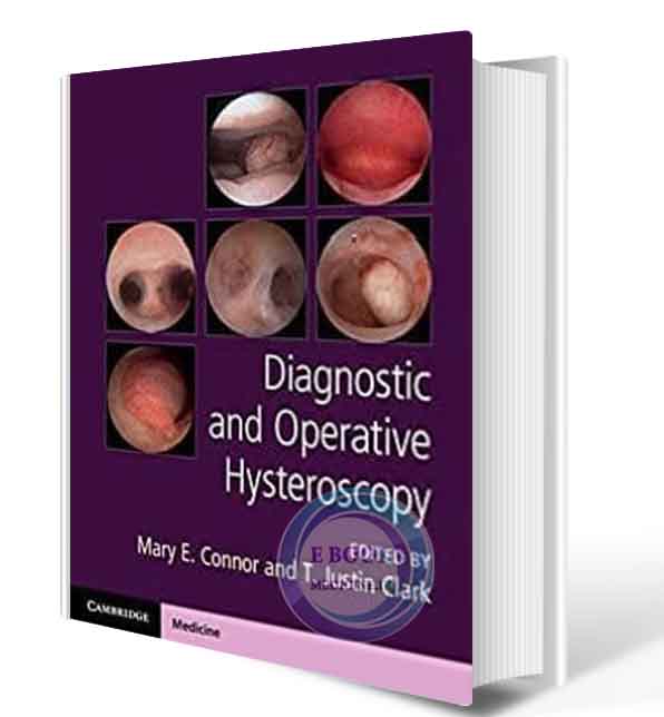 دانلود کتاب Connor  Diagnostic and Operative Hysteroscopy2020(ORIGINAL PDF)